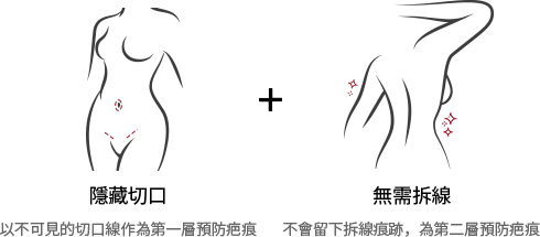 透過360˚吸脂打造流暢纖細的手臂線條